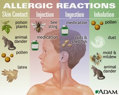 types of alergy